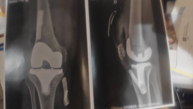 Allez soyons fou, un peu d'intimité...